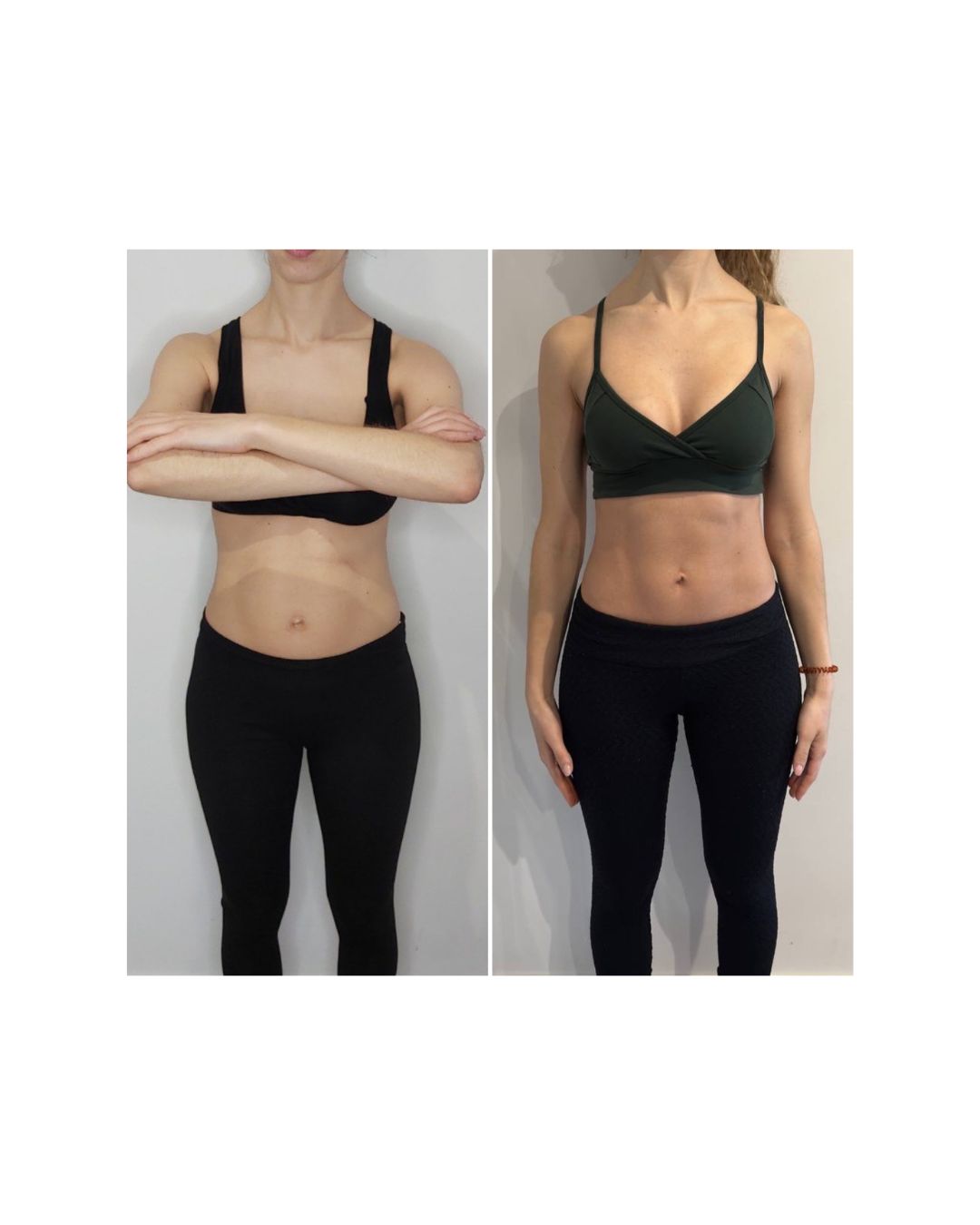 Antes e depois