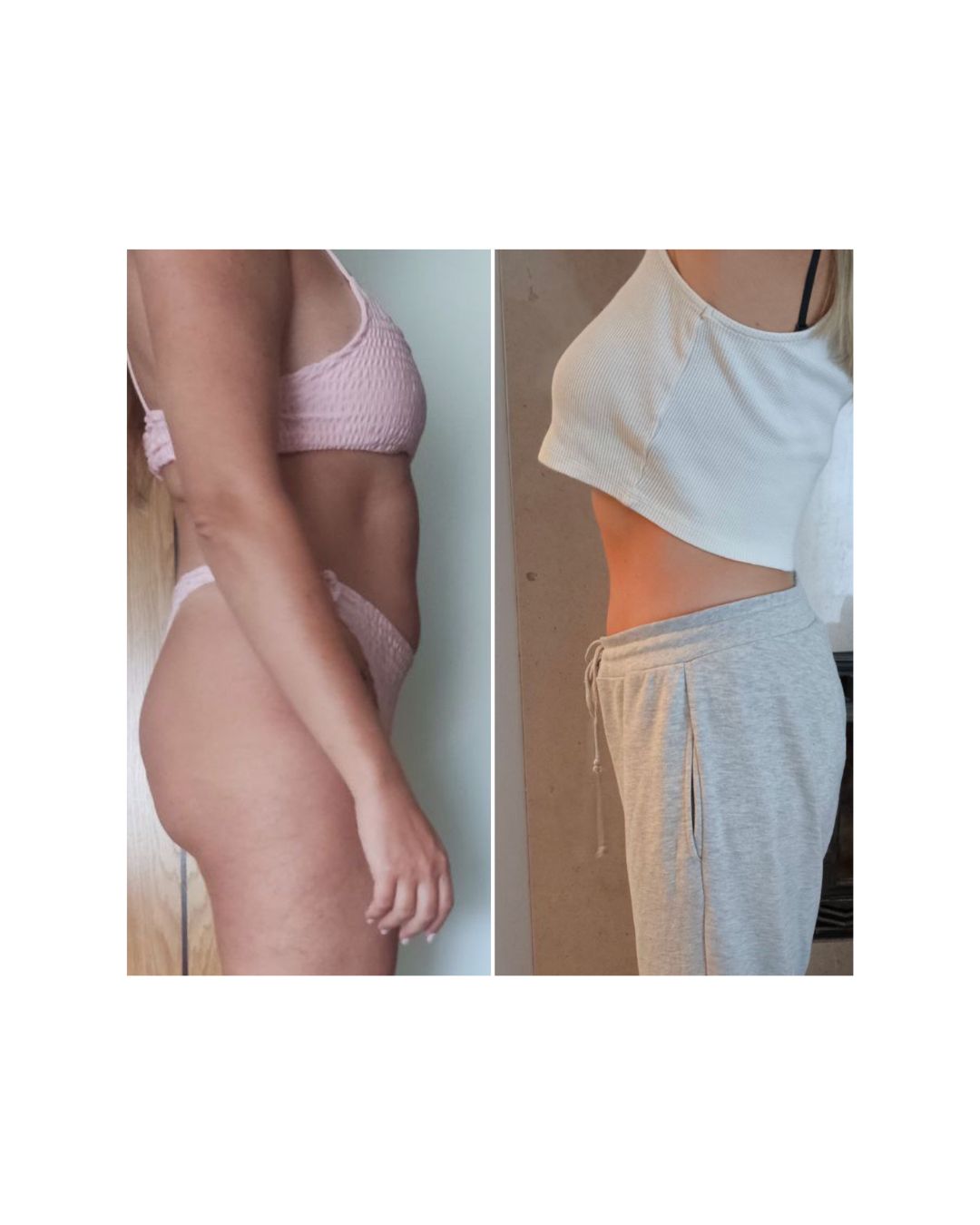 Antes e depois